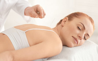 8 Great Reasons to Try Acupuncture