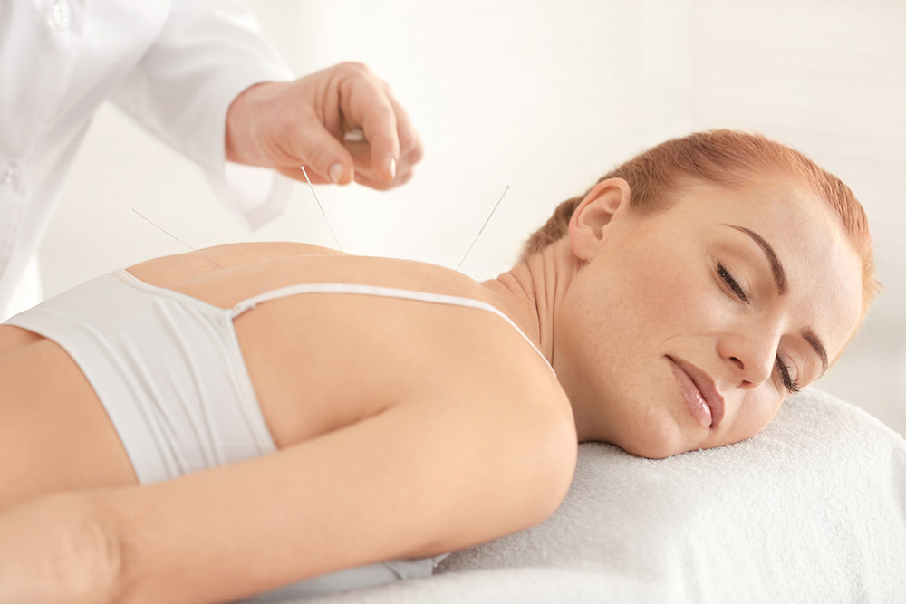 woman receiving acupuncture treatment