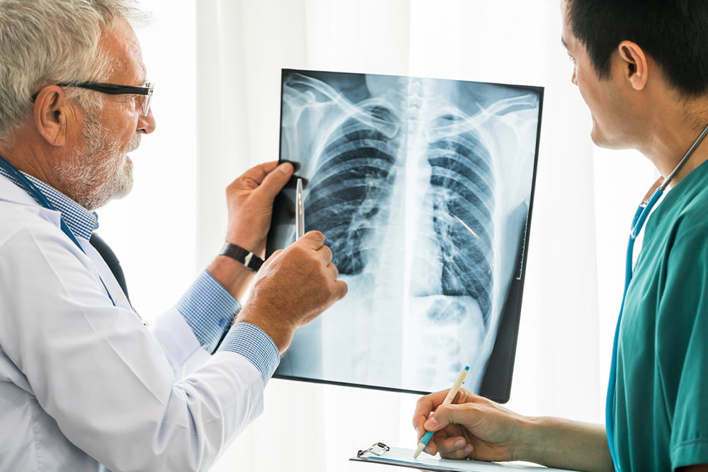 senior male doctor looking at x-ray film of patient chest injury