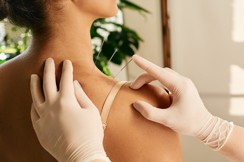 Reflexologist hand with acupuncture needle close-up during insert needle into a woman's shoulder for treatment